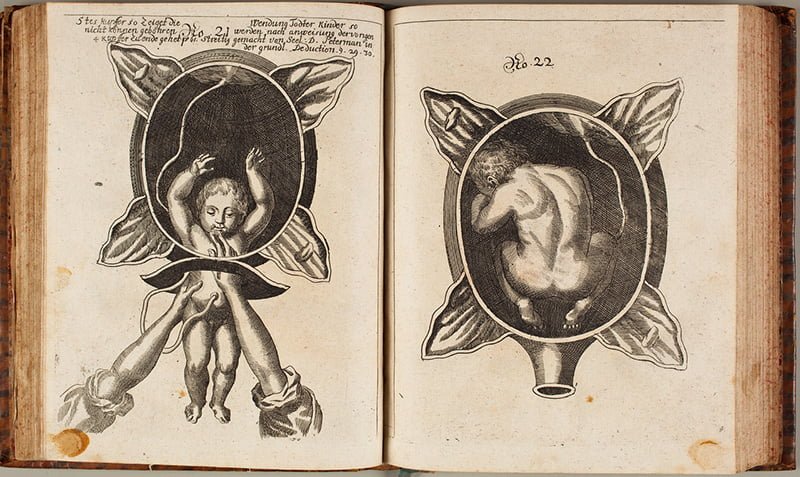 Doğum - SIEGEMUNDIN, Justine (1650-1705)